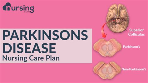nursing teaching plan for parkinson's disease