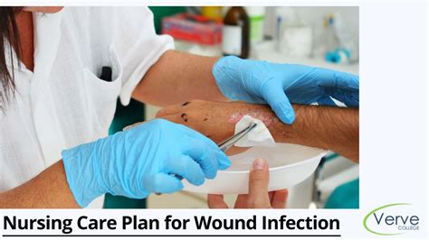 Nursing Treatment Options