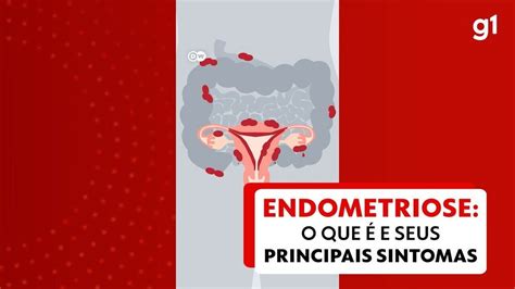 o que e endometriose e seus sintomas