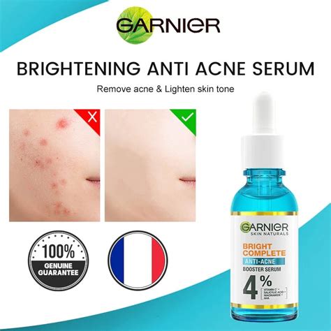 Obat Jerawat Garnier: Wajah Cerah Bebas Jerawat