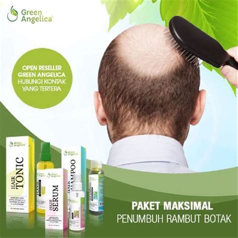 Obat Penumbuh Rambut Botak: Rahasia Meraih Rambut Tebal dan Sehat