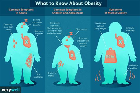 obesity diagnosis