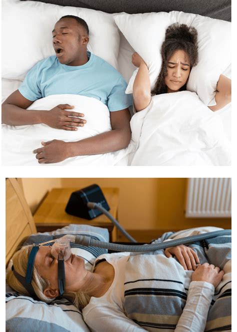 obstructive sleep apnea icd