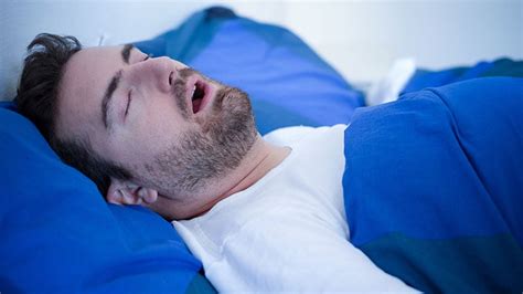 obstructive sleep apnea medscape