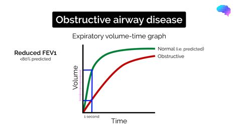Obstructive Spirometry Graph