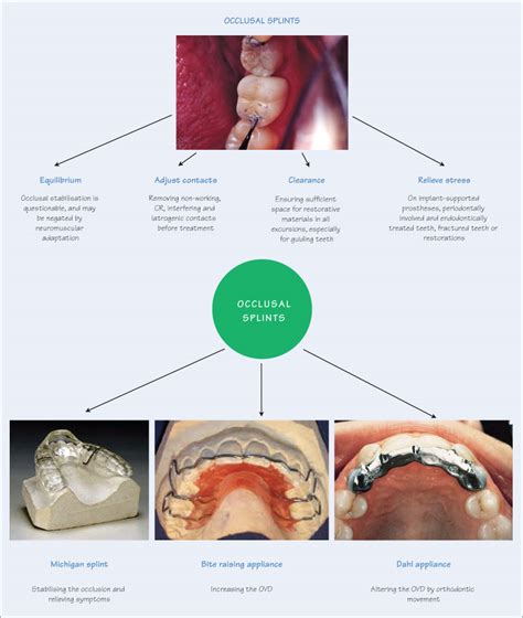 Occlusal Guard Adjustment