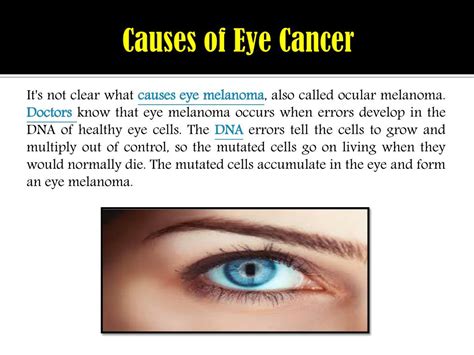 ocular melanoma cancer symptoms