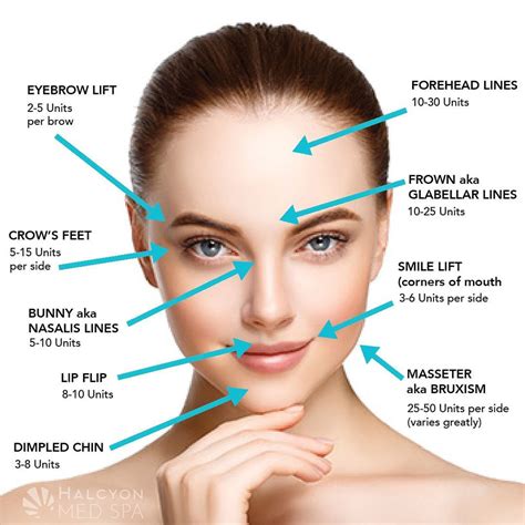 off label uses for botox