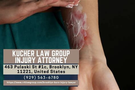 oklahoma burn injury lawyer