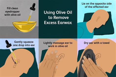 EASY REMOVAL OF EARWAX WITH HYDROGEN PEROXIDE Ear wax, Clean ear wax