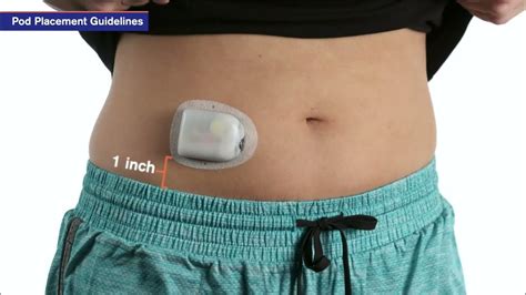 Omnipod Dash Training Videos