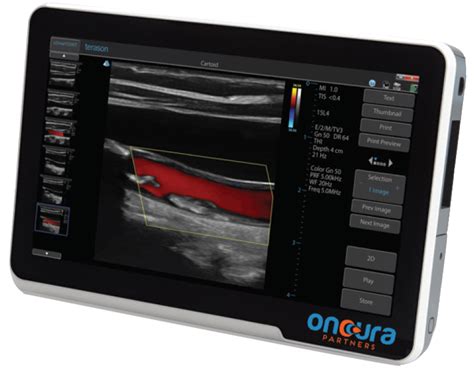 Oncura Partners Holdings Introduces First RealTime Telemedicine