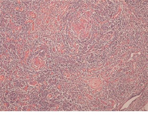 Onion Skin Appearance