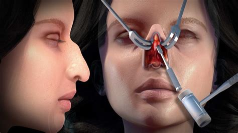 Understanding the Complex Operation of Nose and Sinuses Function