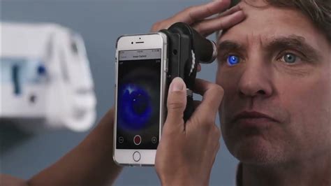 Ophthalmoscope Tutorial