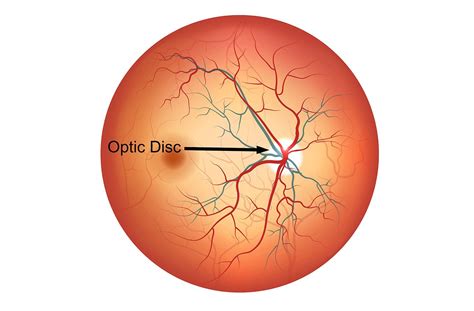 Optic Disc Eyeball