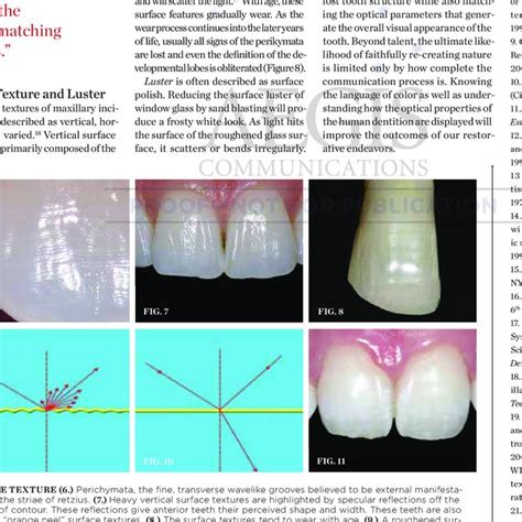 Optical Properties Of Teeth