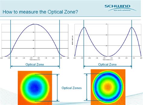 Optical Zone Definition