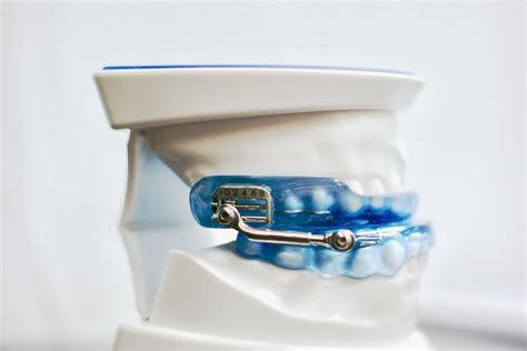oral appliance therapy reviews