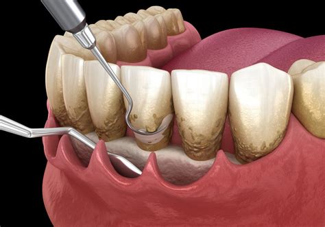 oral surgery and periodontics