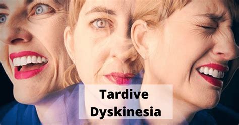 orofacial dyskinesia vs tardive dyskinesia