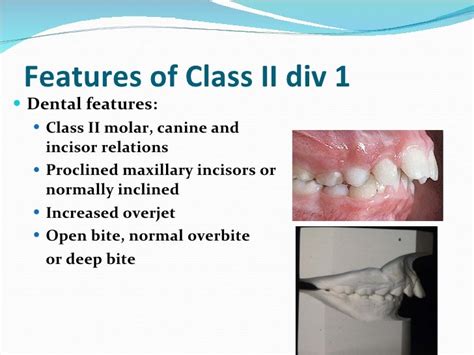 Ortho Class 2 Div 1