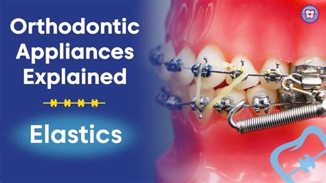 Orthodontic Elastics Explained