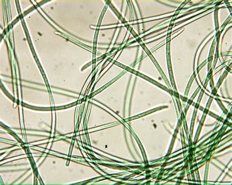 Oscillatoria Under Microscope