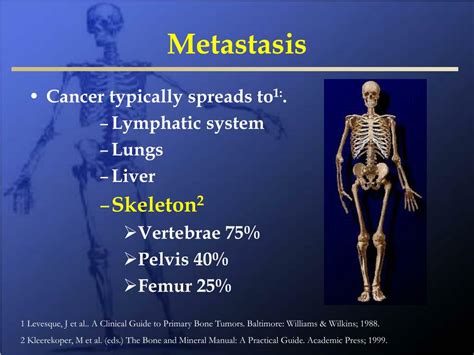 osseous metastatic disease prognosis