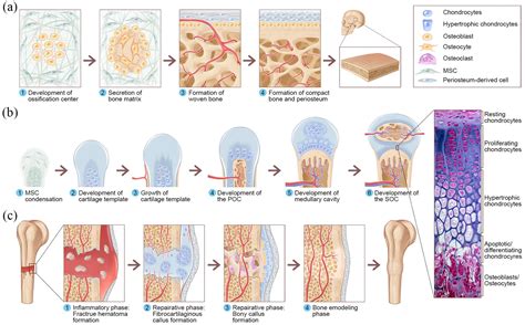 ossification