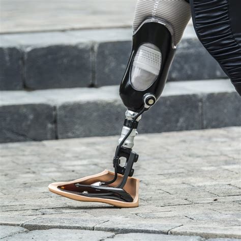 ossur prosthetics jobs