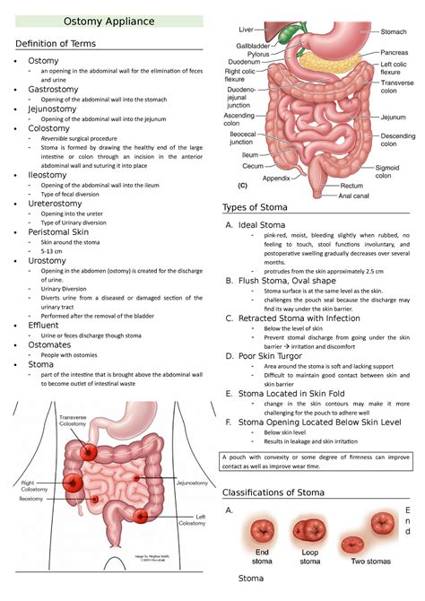Ostomy Sentence Examples