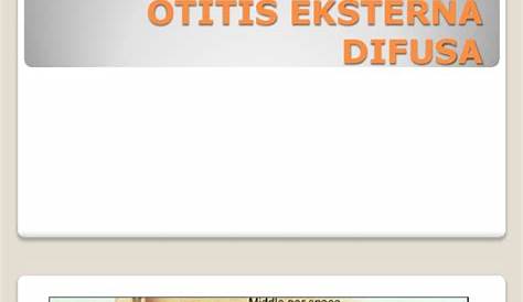 Otitis Eksterna Difusa Icd 10 Kode Tht Ear Larynx