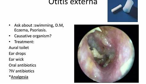Otitis Externa Practice Essentials Background Anatomy