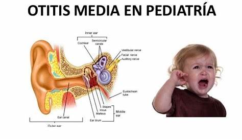 Otitis Media Aguda Ninos Confederacion Farmaceutica Argentina Antibioticos Para La