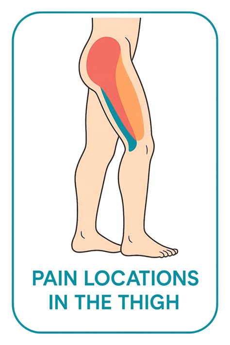 Relieve Outer Thigh Pain: What You Need to Know About Causes and Effective Treatments