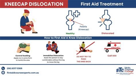 outline the general first aid procedure for treating a dislocation