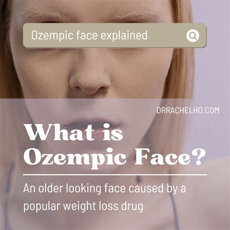 ozempic face meaning