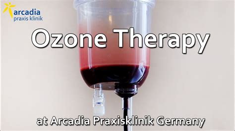 Ozone Therapy Germany