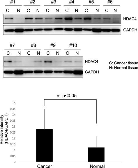p-hdac4 antibody