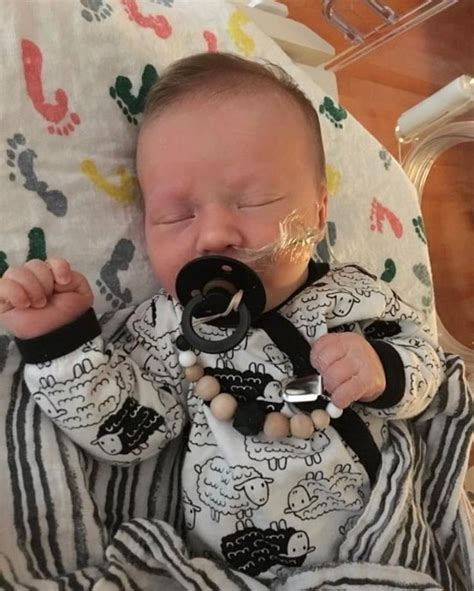 Pacifiers For High Palate