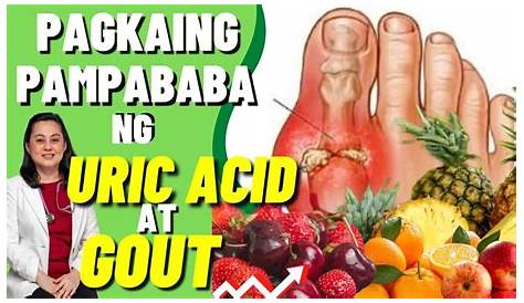 Bawal Na Pagkain Sa May Uric Acid