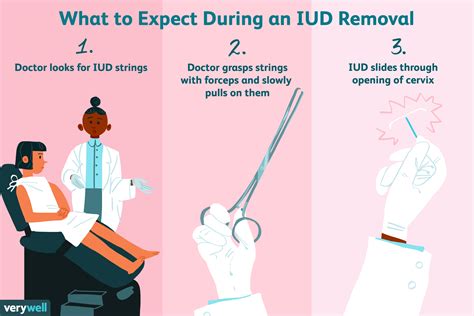 pain after iud replacement