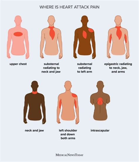 Pain In Left Chest When Inhaling Deeply