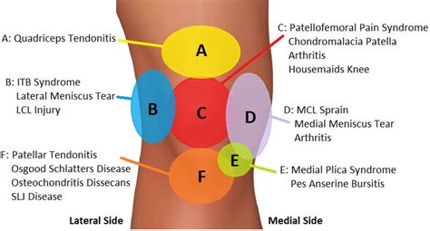 pain inside of left knee diagnosis chart