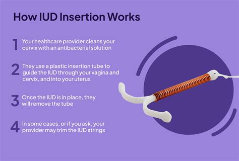 pain medication for iud insertion