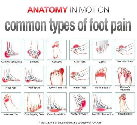 painful toes on left foot