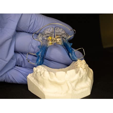 Palate Expander At Home