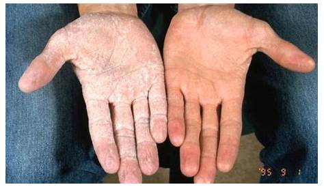 Por qué tenemos líneas en las palmas de las manos| Salud180