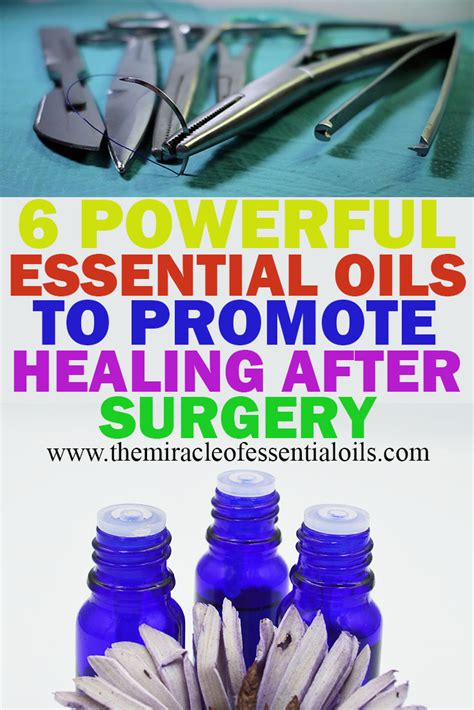 pao surgery doterra essential oils